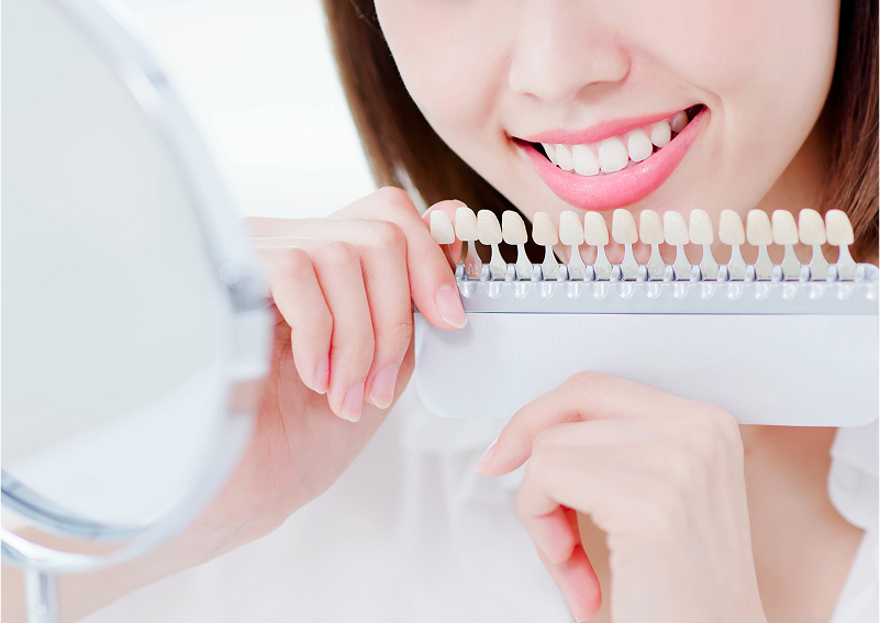 ホワイトニング